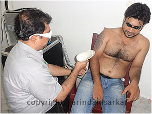 hairremoval-1